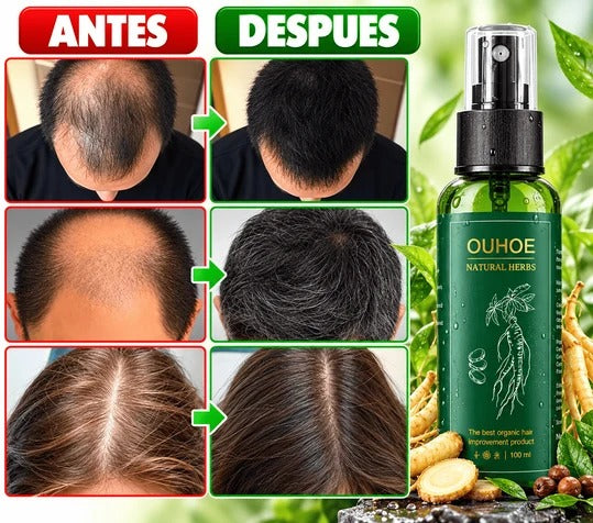 Elixir Capilar Anti-Caída y Crecimiento